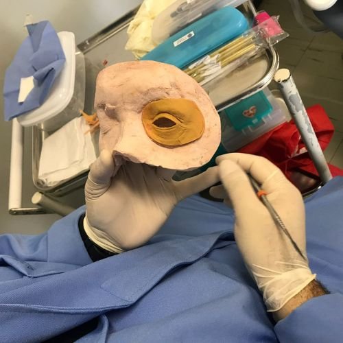 Prótese Bucomaxilo em Porto Alegre Bucomaxilofacial implantes prótese bucomaxilofacial odontologia hospitalar em porto alegre buco1 (3)