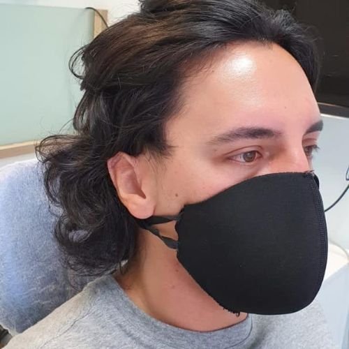 Bucomaxilofacial implantes prótese bucomaxilofacial odontologia hospitalar em porto alegre buco4 (2)