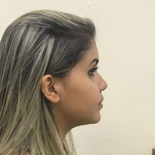 Design sem nome - 1