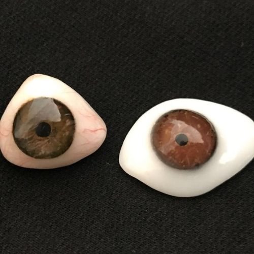 Bucomaxilofacial implantes prótese bucomaxilofacial odontologia hospitalar em porto alegre buco protese bucomaxilofacial (2)