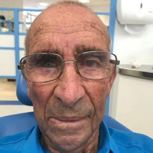 Bucomaxilofacial implantes prótese bucomaxilofacial odontologia hospitalar em porto alegre buco protese bucomaxilofacial (4)